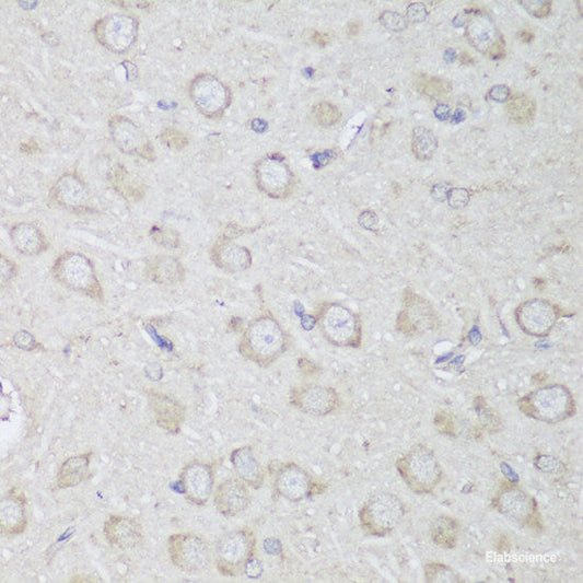 Immunofluorescence analysis of C6 cells using PTPN22 Polyclonal Antibody at dilution of  1:100. Blue: DAPI for nuclear staining.