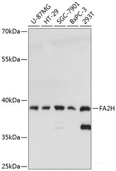 Immunohistochemistry of paraffin-embedded Rat spleen using IKBKE Polyclonal Antibody at dilution of  1:100 (40x lens).