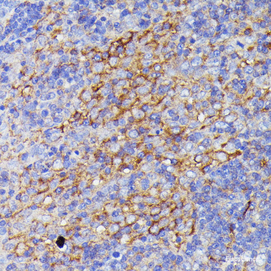 Immunofluorescence analysis of A549 cells using PRKAG3 Polyclonal Antibody