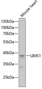Immunohistochemistry of paraffin-embedded Human stomach using SETD5 Polyclonal Antibody at dilution of  1:100 (40x lens).