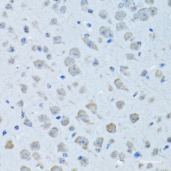 Immunohistochemistry of paraffin-embedded Human appendix using TGFBR2 Polyclonal Antibody at dilution of  1:100 (40x lens).