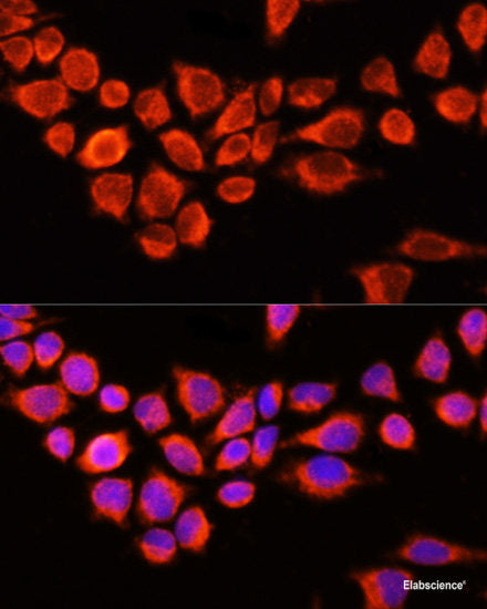 Immunohistochemistry of paraffin-embedded Human uterus using ESRRA Polyclonal Antibody at dilution of  1:200 (40x lens).