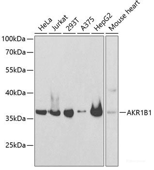 Immunofluorescence analysis of U2OS cells using RUVBL1 Polyclonal Antibody at dilution of  1:100. Blue: DAPI for nuclear staining.