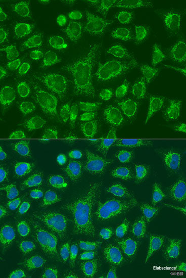 Immunohistochemistry of paraffin-embedded Human liver using APOA5 Polyclonal Antibody at dilution of  1:100 (40x lens).