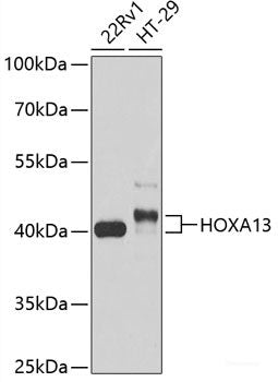 Immunohistochemistry of paraffin-embedded Human prostate using SELP Polyclonal Antibody at dilution of  1:100 (40x lens).