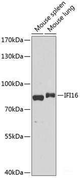 Immunohistochemistry of paraffin-embedded Rat brain using RPL21 Polyclonal Antibody at dilution of  1:100 (40x lens).