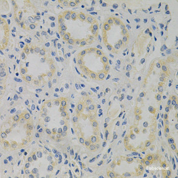 Immunohistochemistry of paraffin-embedded Rat liver using PRKAG2 Polyclonal Antibody at dilution of  1:100 (40x lens).