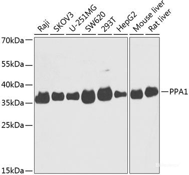 Immunohistochemistry of paraffin-embedded Rat brain using ZNF703 Polyclonal Antibody at dilution of  1:100 (40x lens).