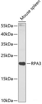 Western blot analysis of extracts of various cell lines using NDUFAF4 Polyclonal Antibody at dilution of 1:3000.