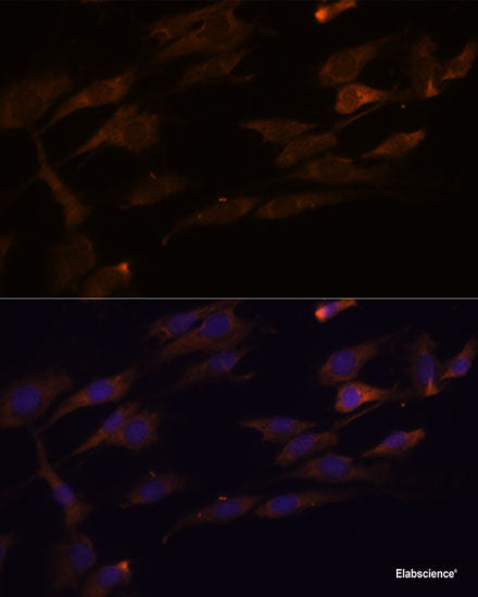 Immunofluorescence analysis of NIH/3T3 cells using SLC25A23 Polyclonal Antibody at dilution of  1:100. Blue: DAPI for nuclear staining.