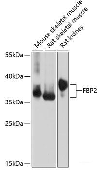 Immunohistochemistry of paraffin-embedded Rat pancreas using NME6 Polyclonal Antibody at dilution of  1:100 (40x lens).
