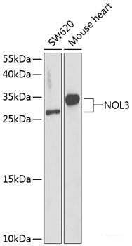 Immunohistochemistry of paraffin-embedded Rat ovary using LRP1 Polyclonal Antibody at dilution of  1:100 (40x lens).