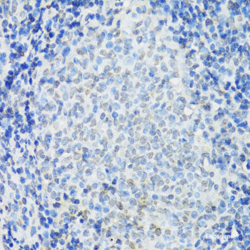 Immunohistochemistry of paraffin-embedded Rat liver using CCDC59 Polyclonal Antibody at dilution of  1:100 (40x lens).