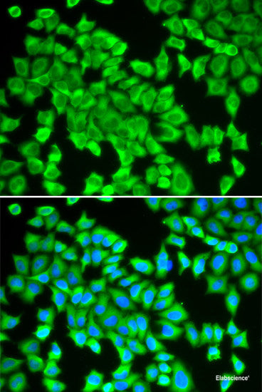 Immunofluorescence analysis of NIH-3T3 cells using TXNDC12 Polyclonal Antibody at dilution of  1:100 (40x lens). Blue: DAPI for nuclear staining.
