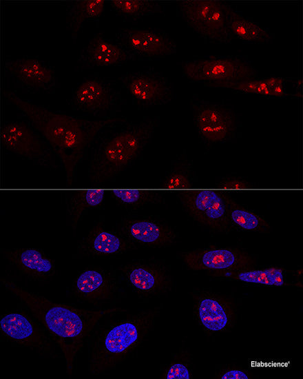Immunohistochemistry of paraffin-embedded Mouse testis using CCDC124 Polyclonal Antibody at dilution of  1:100 (40x lens).