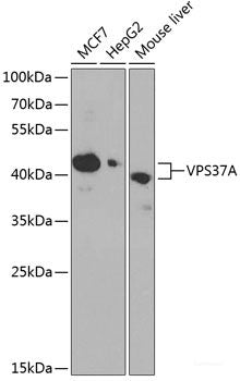 Immunohistochemistry of paraffin-embedded Human colon using CA13 Polyclonal Antibody at dilution of  1:100 (40x lens).