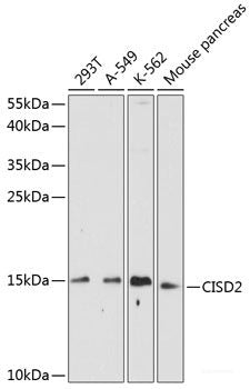 Immunohistochemistry of paraffin-embedded Rat heart using MZB1 Polyclonal Antibody at dilution of  1:100 (40x lens).