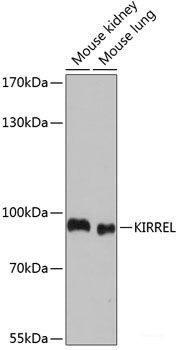 Immunohistochemistry of paraffin-embedded Rat testis using SLC2A9 Polyclonal Antibody at dilution of  1:100 (40x lens).