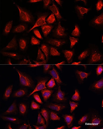 Immunofluorescence analysis of HeLa cells using DCX Polyclonal Antibody at dilution of  1:100. Blue: DAPI for nuclear staining.