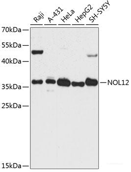 Immunohistochemistry of paraffin-embedded Rat kidney using RPS27A Polyclonal Antibody at dilution of  1:100 (40x lens).