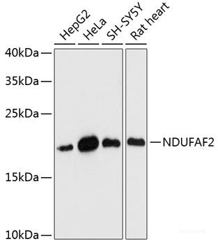 Immunofluorescence analysis of Rat eye using MYH13 Polyclonal Antibody at dilution of  1:100 (40x lens). Blue: DAPI for nuclear staining.