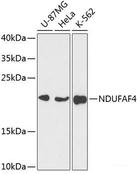 Immunohistochemistry of paraffin-embedded Rat brain using CDH18 Polyclonal Antibody at dilution of  1:100 (40x lens).