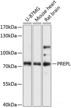 Immunohistochemistry of paraffin-embedded Rat liver using HMGN1 Polyclonal Antibody at dilution of  1:100 (40x lens).