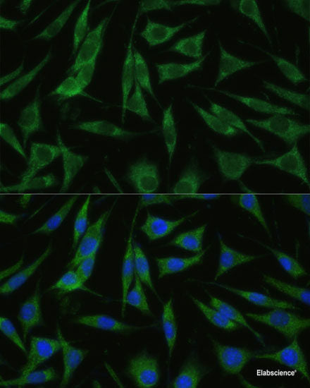 Immunohistochemistry of paraffin-embedded Rat spleen using IL4R Polyclonal Antibody at dilution of  1:100 (40x lens).