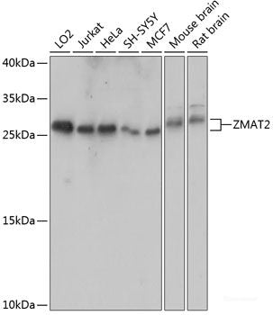 Immunohistochemistry of paraffin-embedded Human uterus using XBP1 Polyclonal Antibody at dilution of  1:100 (40x lens).
