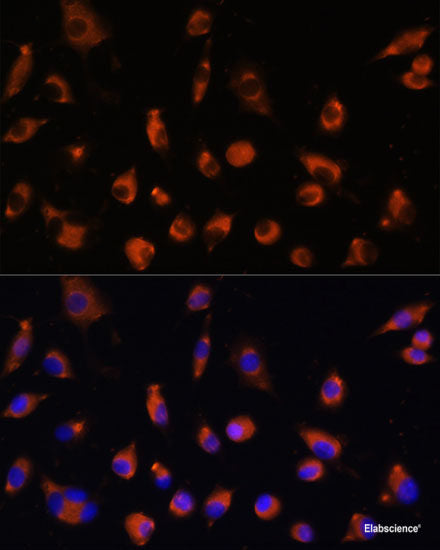 Immunohistochemistry of paraffin-embedded Mouse kidney using PDGFD Polyclonal Antibody at dilution of  1:100 (40x lens).
