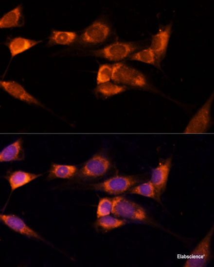 Immunofluorescence analysis of C6 cells using ABCB11 Polyclonal Antibody at dilution of  1:100. Blue: DAPI for nuclear staining.