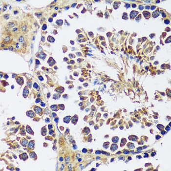 Immunofluorescence analysis of THP-1 cells using CD36 Polyclonal Antibody at dilution of  1:100. Blue: DAPI for nuclear staining.