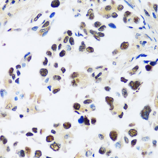 Immunofluorescence analysis of HeLa cells using CDK11B Polyclonal Antibody at dilution of  1:100. Blue: DAPI for nuclear staining.
