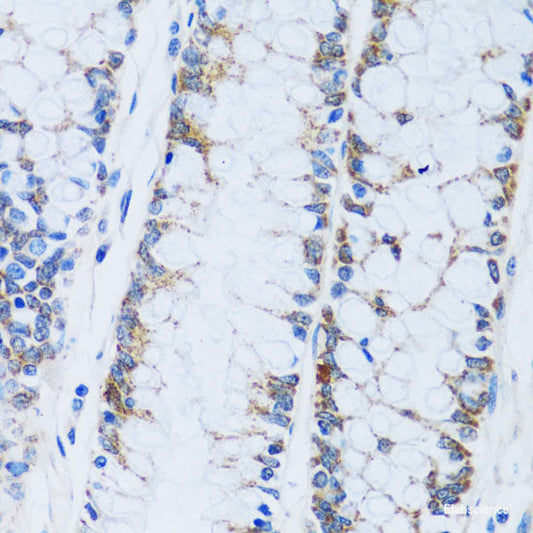 Western blot analysis of extracts of Mouse lung using BCAM Polyclonal Antibody at dilution of 1:1000.