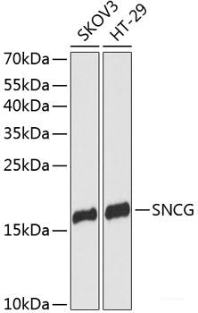 Immunofluorescence analysis of L929 cells using PDE6D Polyclonal Antibody at dilution of  1:100 (40x lens). Blue: DAPI for nuclear staining.