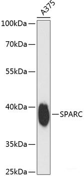 Immunohistochemistry of paraffin-embedded Human gastric cancer using ENPP3 Polyclonal Antibody at dilution of  1:150 (40x lens).