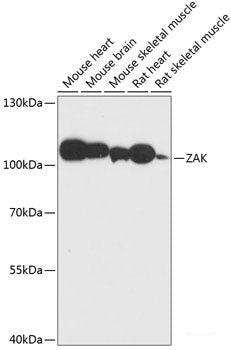Immunohistochemistry of paraffin-embedded Human lung using RB1 Polyclonal Antibody at dilution of  1:100 (40x lens).