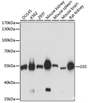 Immunohistochemistry of paraffin-embedded Rat pancreas using ZNF177 Polyclonal Antibody at dilution of  1:100 (40x lens).