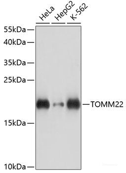 Immunohistochemistry of paraffin-embedded Human liver using SLC16A4 Polyclonal Antibody at dilution of  1:100 (40x lens).