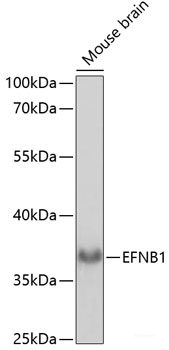 Immunohistochemistry of paraffin-embedded Rat heart using TLK1 Polyclonal Antibody at dilution of  1:100 (40x lens).