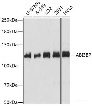 Immunofluorescence analysis of L929 cells using SWAP70 Polyclonal Antibody at dilution of  1:100. Blue: DAPI for nuclear staining.