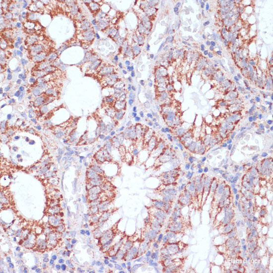 Immunohistochemistry of paraffin-embedded Human liver using ITGB3BP Polyclonal Antibody at dilution of  1:100 (40x lens).