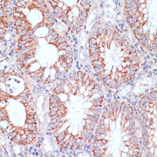 Immunohistochemistry of paraffin-embedded Human liver using ITGB3BP Polyclonal Antibody at dilution of  1:100 (40x lens).