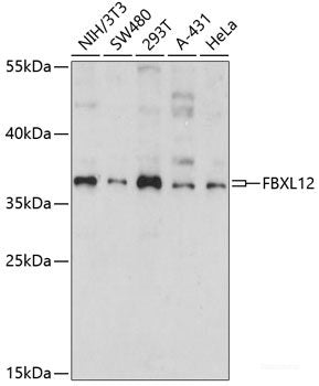 Immunohistochemistry of paraffin-embedded Human uterus using XBP1 Polyclonal Antibody at dilution of  1:100 (40x lens).