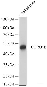 Immunohistochemistry of paraffin-embedded Rat liver using BRMS1 Polyclonal Antibody at dilution of  1:100 (40x lens).