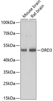 Immunohistochemistry of paraffin-embedded Human lung cancer using ZNF562 Polyclonal Antibody at dilution of  1:100 (40x lens).