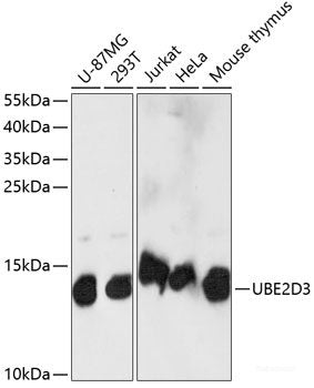 Immunofluorescence analysis of C6 cells using KLHL8 Polyclonal Antibody at dilution of  1:100. Blue: DAPI for nuclear staining.