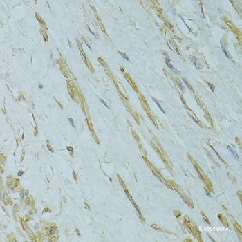 Immunohistochemistry of paraffin-embedded Rat testis using DDX59 Polyclonal Antibody at dilution of  1:100 (40x lens).