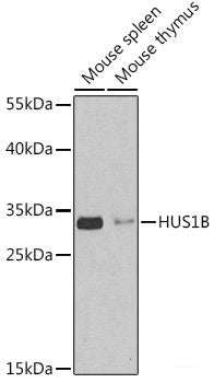 Immunohistochemistry of paraffin-embedded Human appendix using GLB1L3 Polyclonal Antibody at dilution of  1:150 (40x lens).
