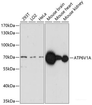 Immunofluorescence analysis of NIH/3T3 cells using KAT6A Polyclonal Antibody at dilution of  1:100. Blue: DAPI for nuclear staining.